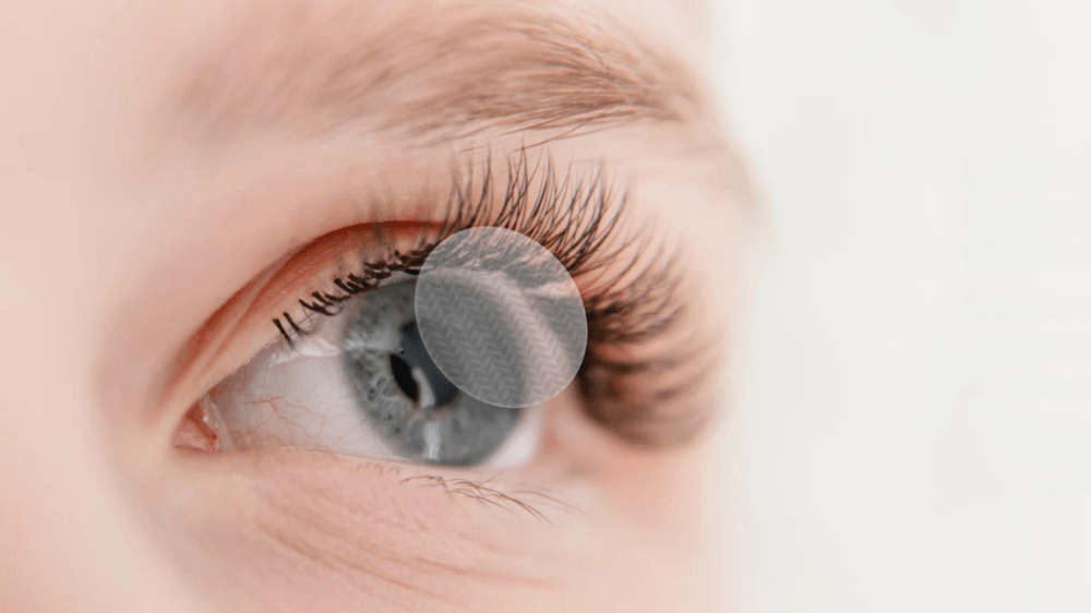 Optometry Practice Growth Through Ocular Surface Care, With Amniotic Membranes