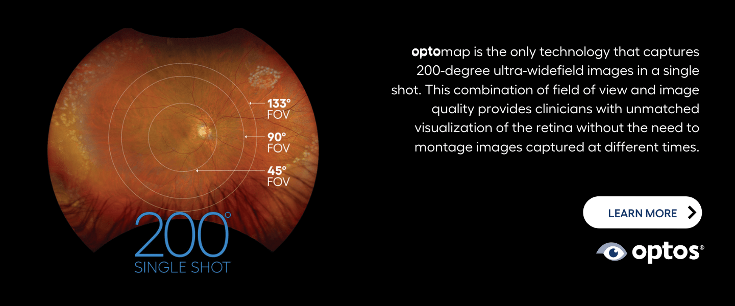 Optos